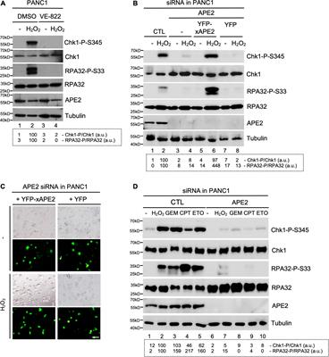 APE2 Is a General Regulator of the ATR-Chk1 DNA Damage Response Pathway to Maintain Genome Integrity in Pancreatic Cancer Cells